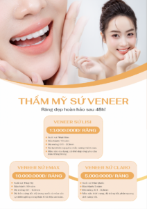 Bảng giá chi phí thẩm mỹ sứ veneer