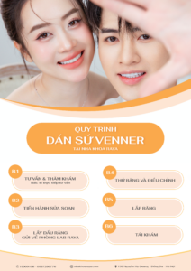 Quy trình dán sứ veneer 